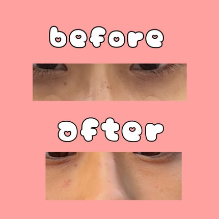 目元ふっくらクリーム NC/なめらか本舗/アイケア・アイクリームを使ったクチコミ(5枚目)