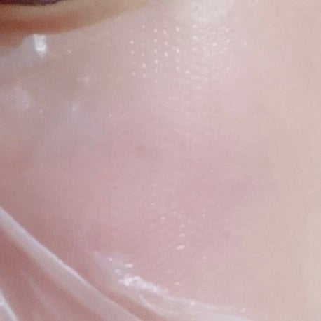 トラブルパッチマスク/EIOM/その他スキンケアを使ったクチコミ(4枚目)