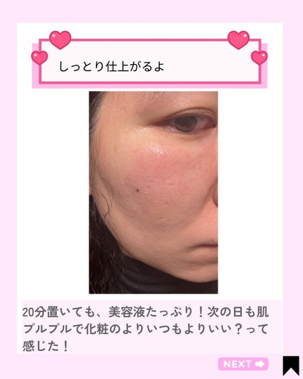 Kana on LIPS 「週1回のご褒美スキンケア🫧日常のケアにプラスしたい集中ケア用の..」(6枚目)