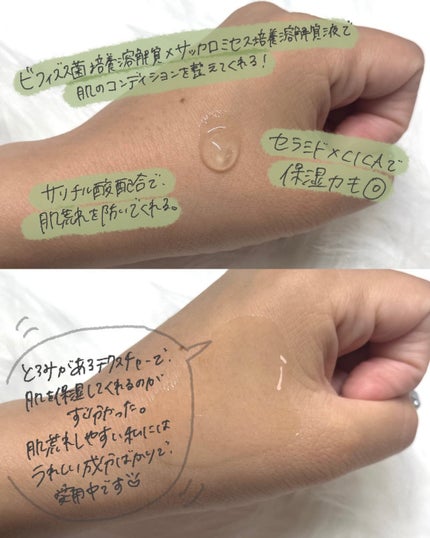 アネトス アクネケア トリートメント セラム/Anetos/美容液を使ったクチコミ(3枚目)