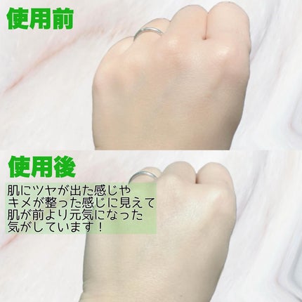 リードルショット100/VT/美容液を使ったクチコミ(4枚目)