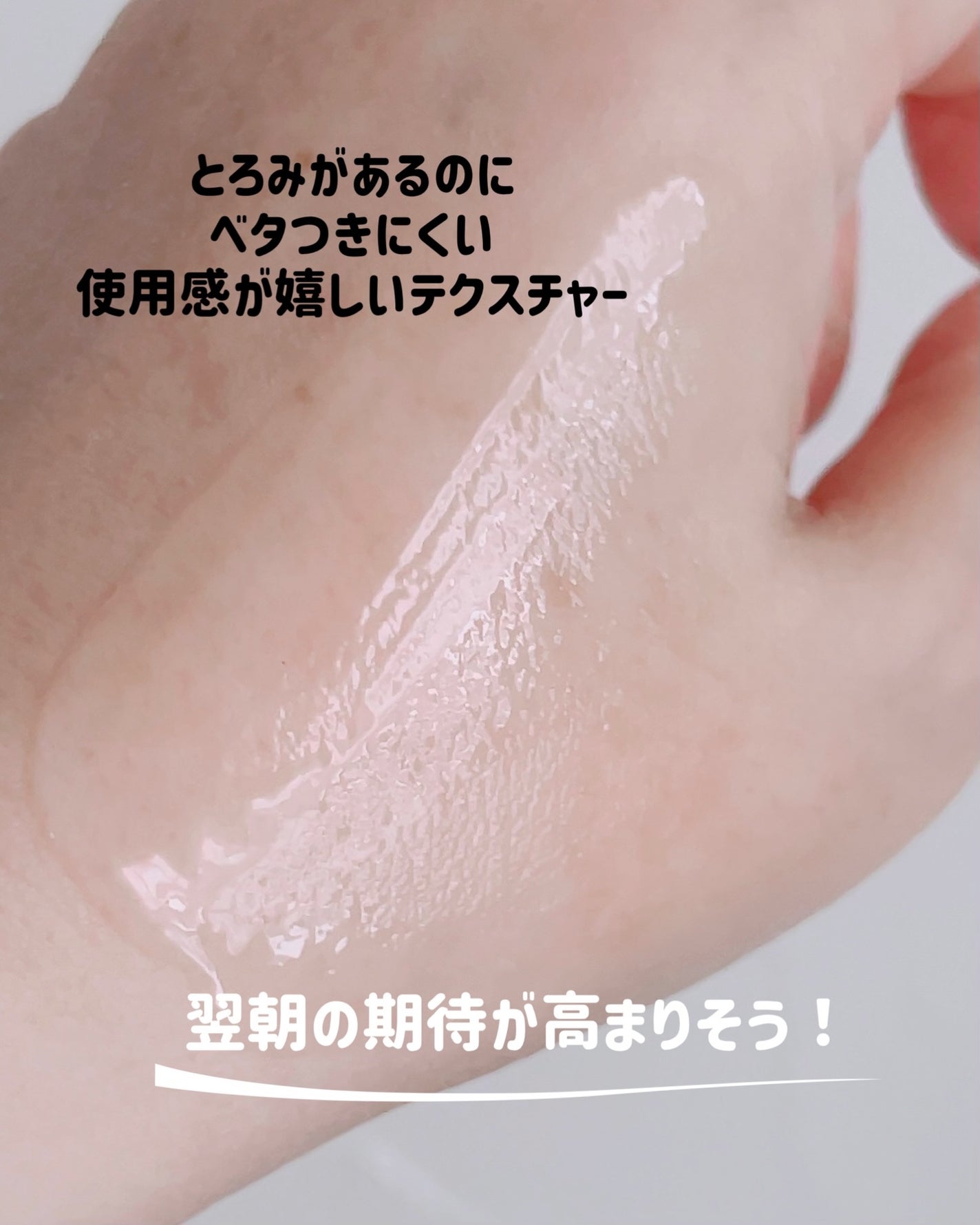 アネトス アクネケア トリートメント セラム/Anetos/美容液を使ったクチコミ(4枚目)