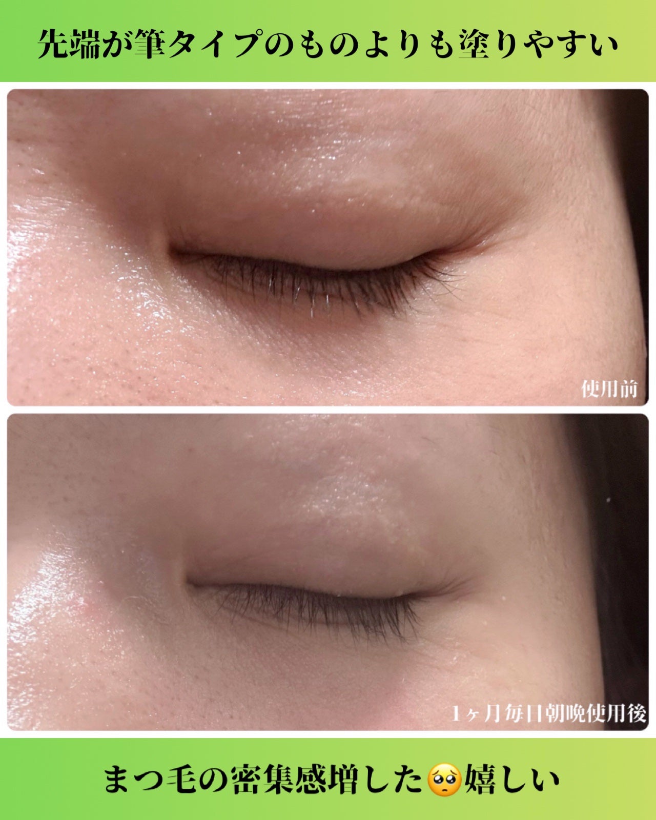 ククイラッシュ まつ毛美容液/KUKUILASH/まつげ美容液を使ったクチコミ(2枚目)