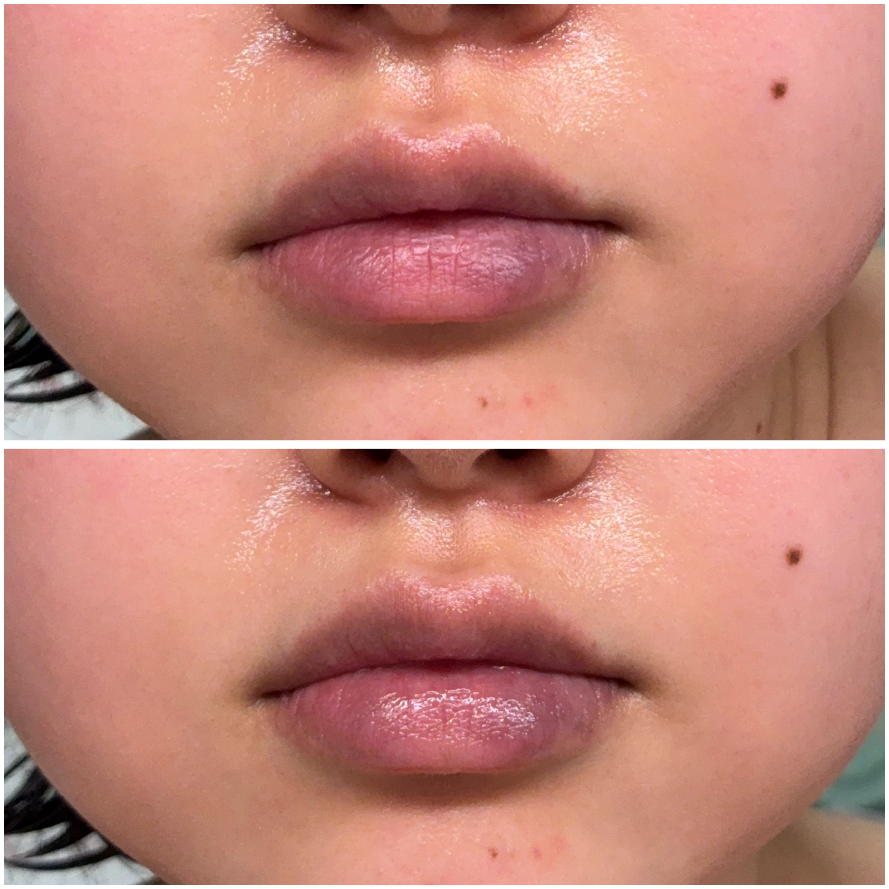 バイオームバリアメルティングモイスチャーリップバーム/UIQ/リップバームを使ったクチコミ（3枚目）