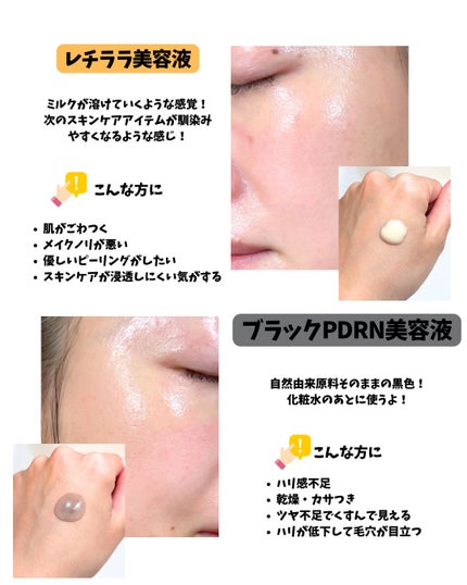 ブラックPDRN 美容液/ネイチャーリパブリック/美容液を使ったクチコミ(4枚目)