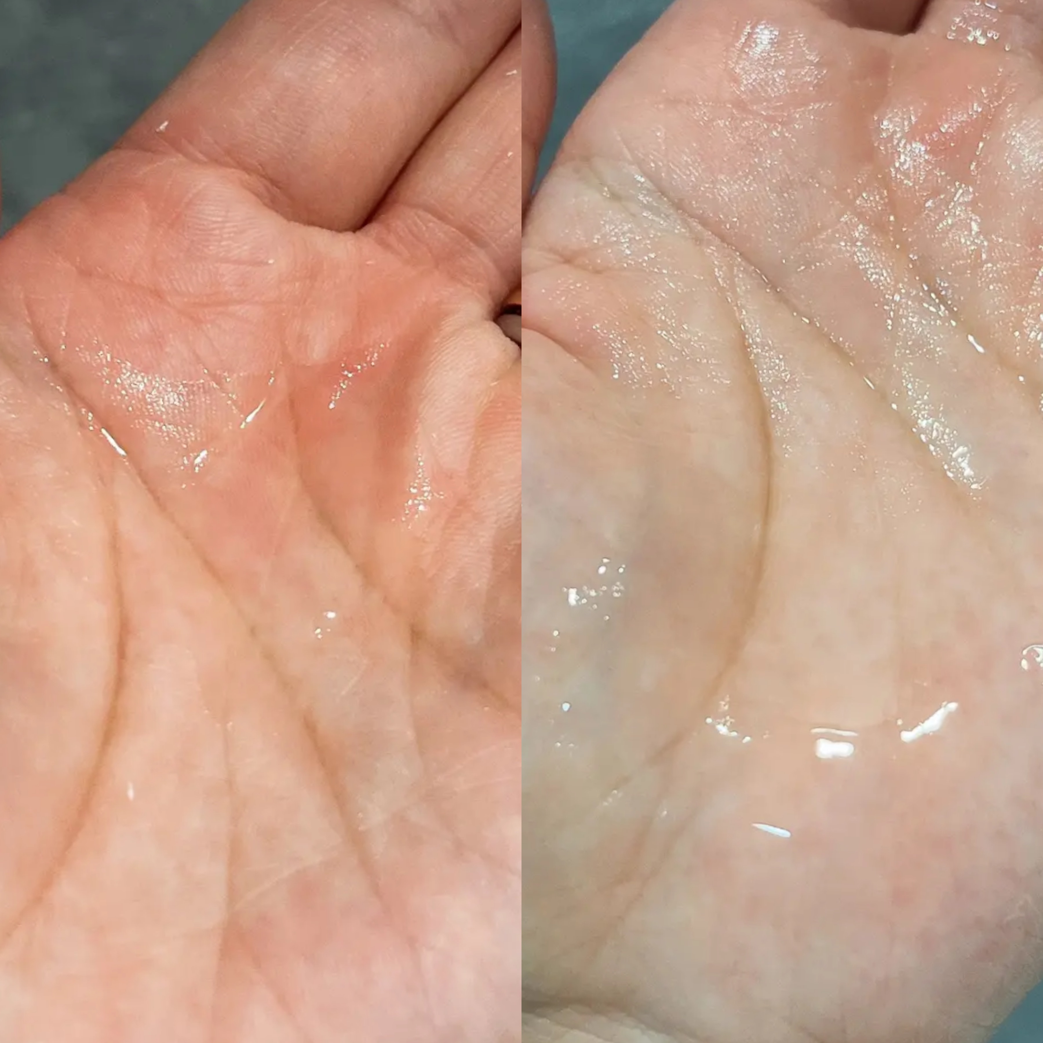 オングリディエンツ スキンバリアカーミングソフナー/Ongredients/化粧水を使ったクチコミ（3枚目）