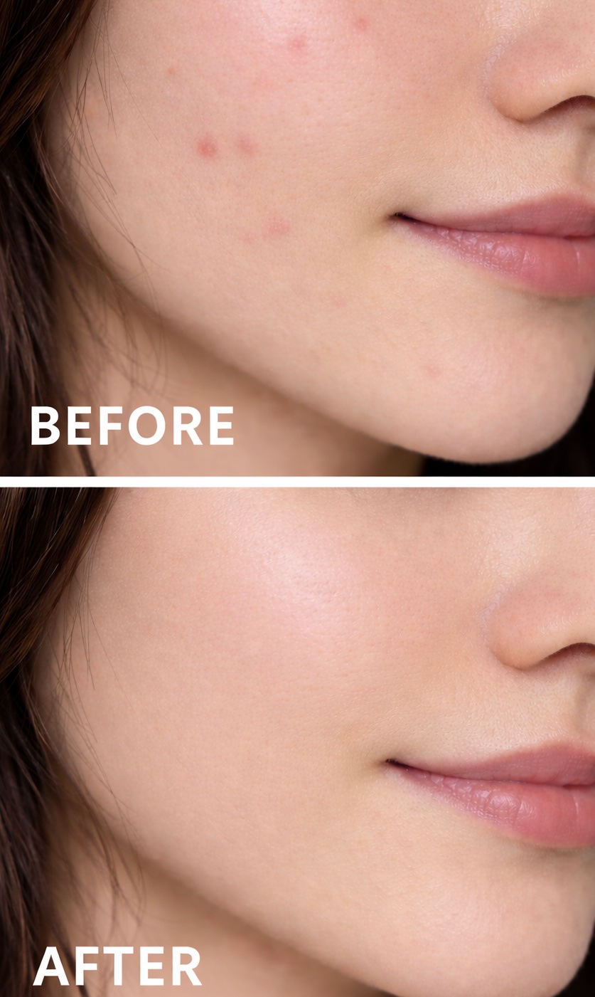 アークパントンヒール /Balance Flow/美容サプリメントを使ったクチコミ（3枚目）