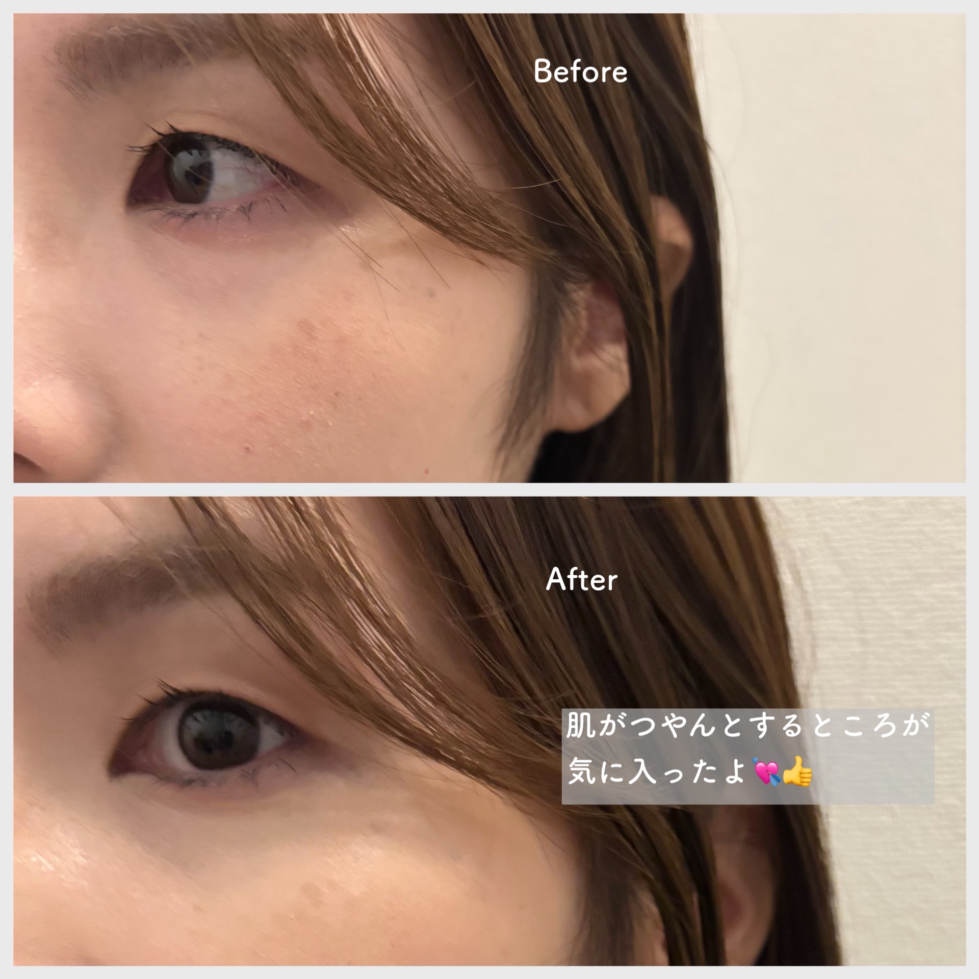 ダーマシンコンシーラー/23years old/リキッドコンシーラーを使ったクチコミ（3枚目）