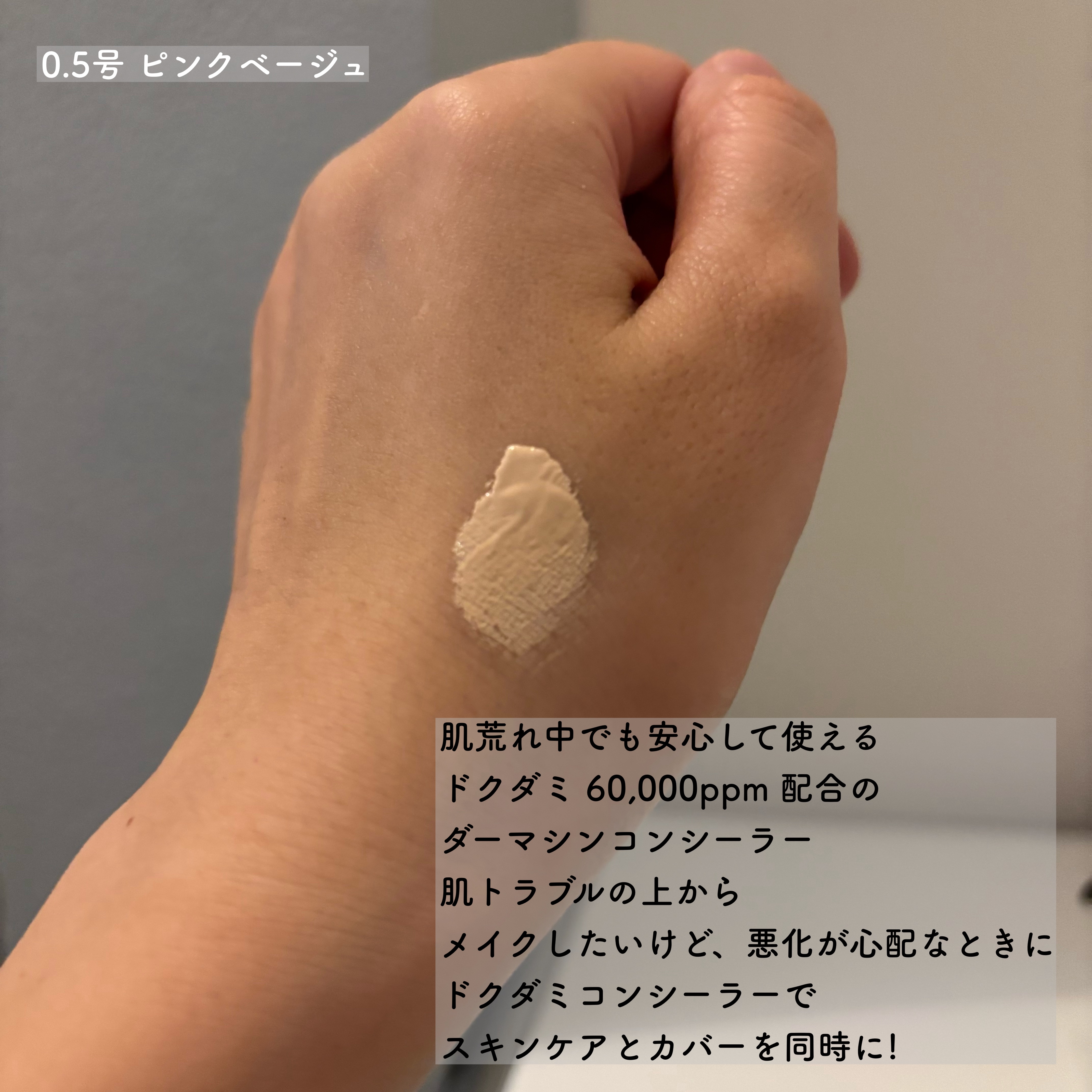 ダーマシンコンシーラー/23years old/リキッドコンシーラーを使ったクチコミ（2枚目）