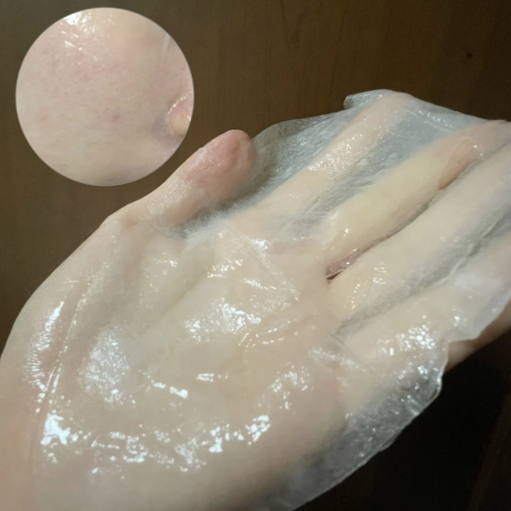 植物性ボトックスマスクパック/CHICSKIN/シートマスク・パックを使ったクチコミ（2枚目）