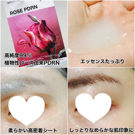 ローゼPDRNエッセンシャルマスクヘルシーグロウ/MEDIHEAL/シートマスク・パックを使ったクチコミ(2枚目)