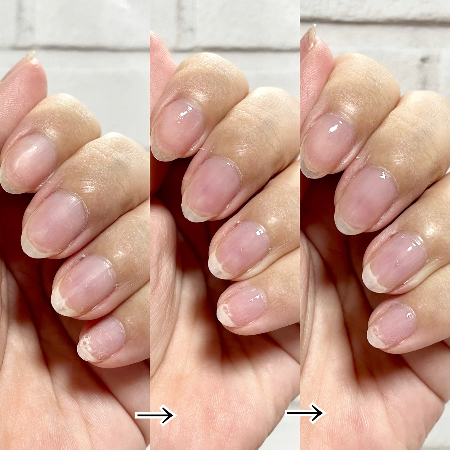 ネイルエンビー/O・P・I/ネイルオイル・トリートメントを使ったクチコミ（3枚目）