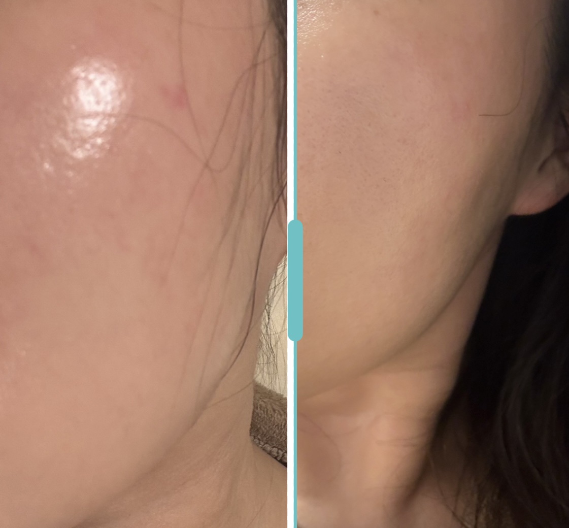 アークパントンヒール /Balance Flow/美容サプリメントを使ったクチコミ（3枚目）