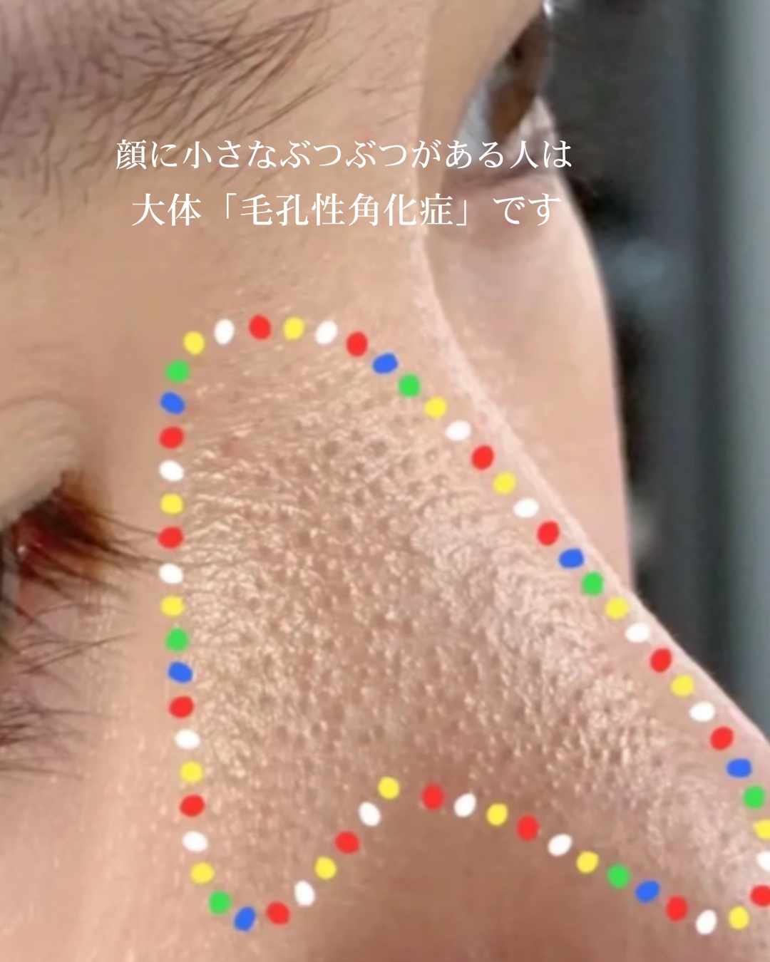 アネトス マイルド フェイシャル クレンザー/Anetos/洗顔フォームを使ったクチコミ（2枚目）