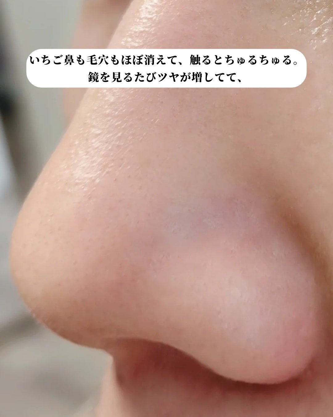 アネトス アクネケア トリートメント セラム/Anetos/美容液を使ったクチコミ(5枚目)