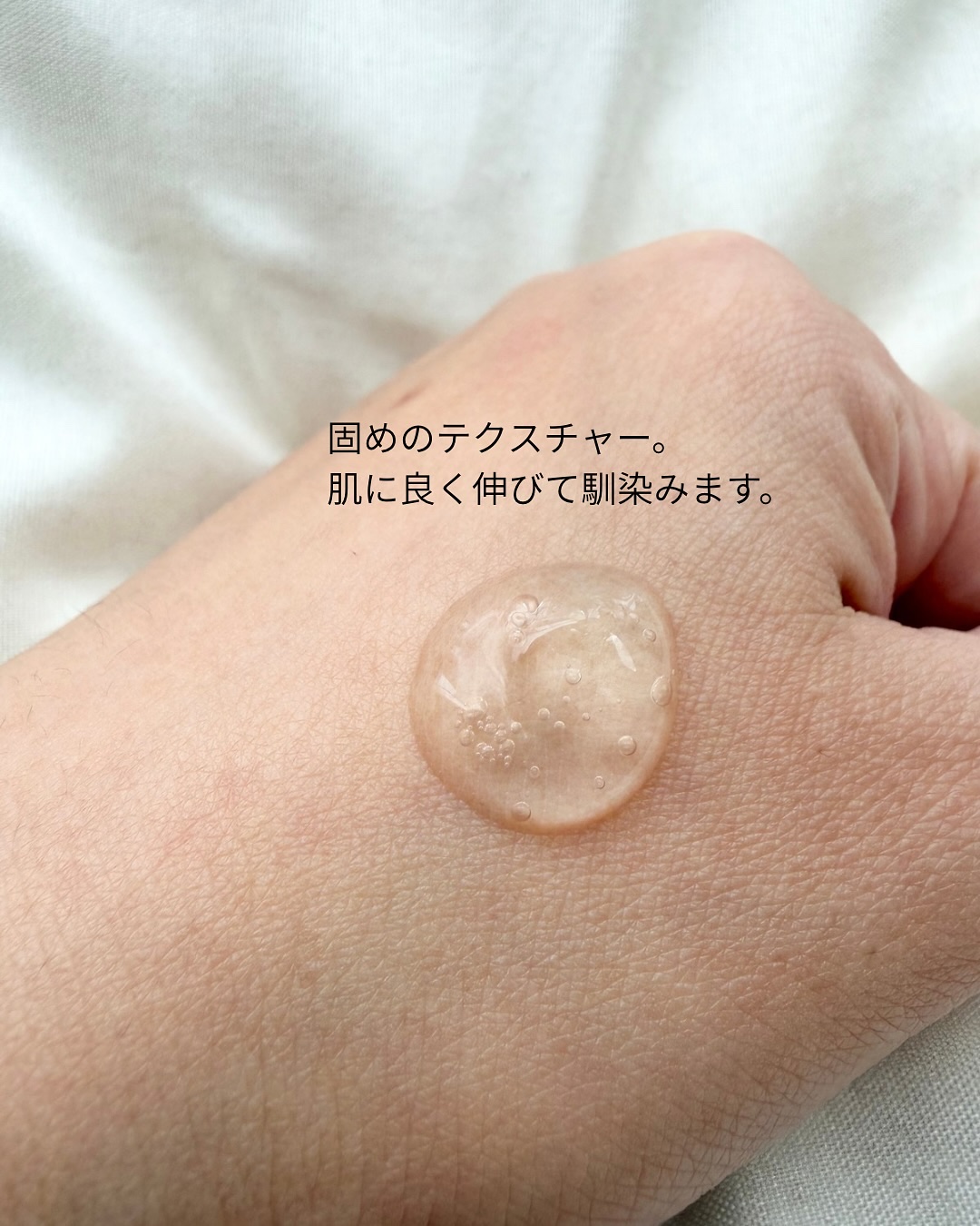 アネトス アクネケア トリートメント セラム/Anetos/美容液を使ったクチコミ（3枚目）