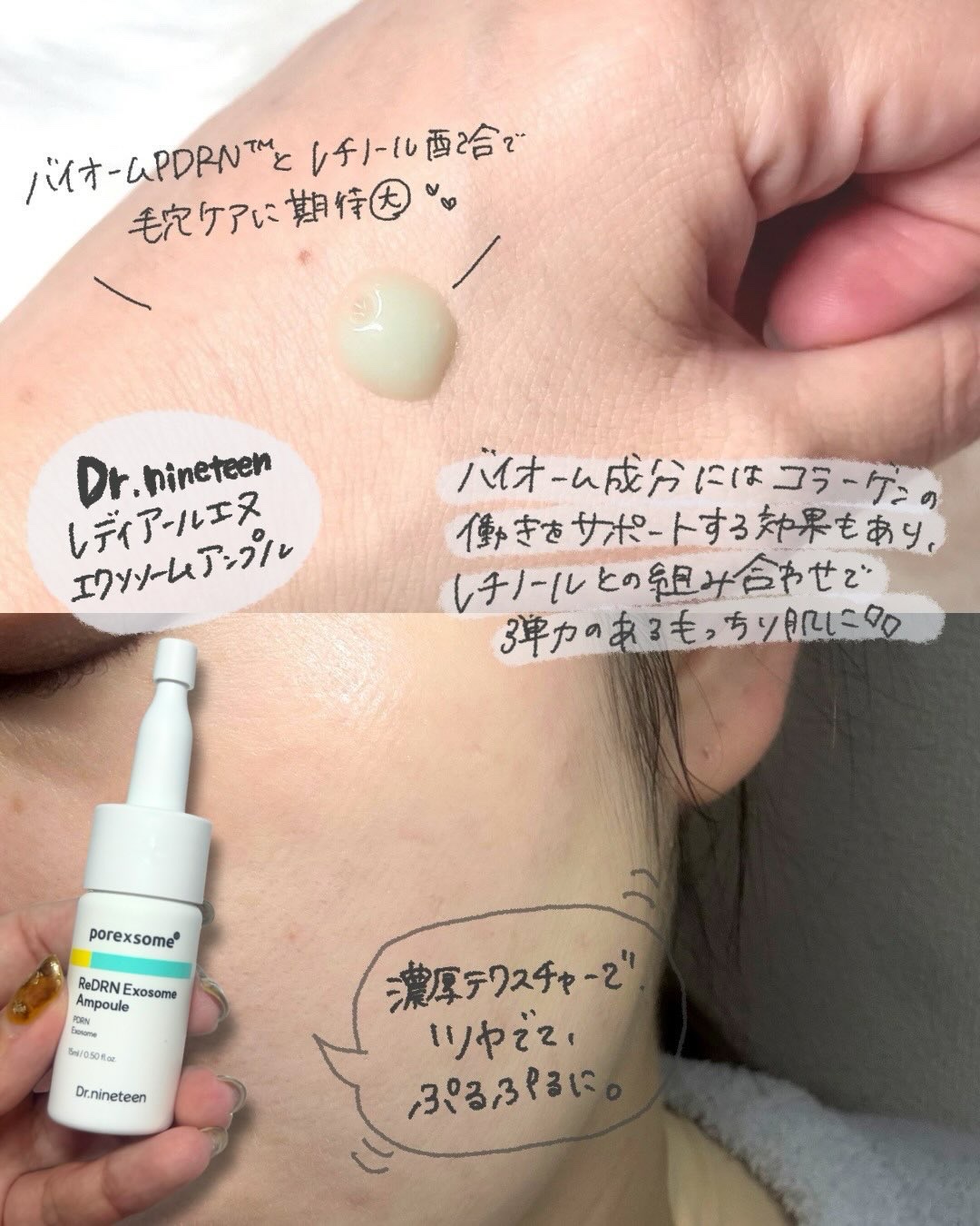 ReDRNエクソソームアンプル/Dr.nineteen/美容液を使ったクチコミ（3枚目）