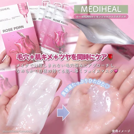 ローゼPDRNエッセンシャルマスクヘルシーグロウ/MEDIHEAL/シートマスク・パックを使ったクチコミ(2枚目)