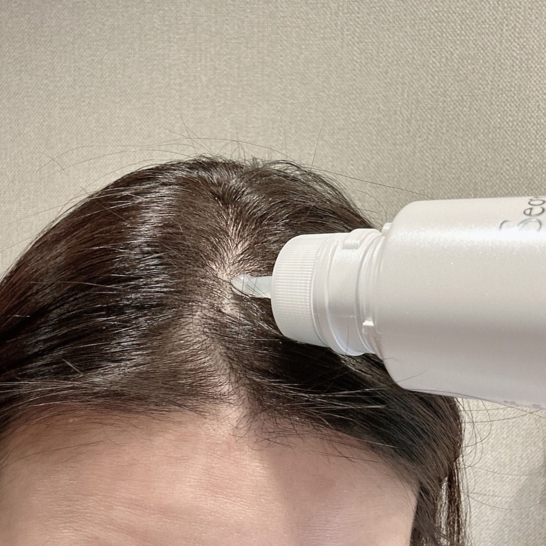 セグレタ 育毛エッセンス/花王/頭皮ローションを使ったクチコミ（3枚目）