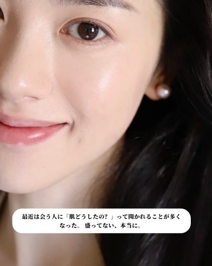 アネトス アクネケア トリートメント セラム/Anetos/美容液を使ったクチコミ(6枚目)