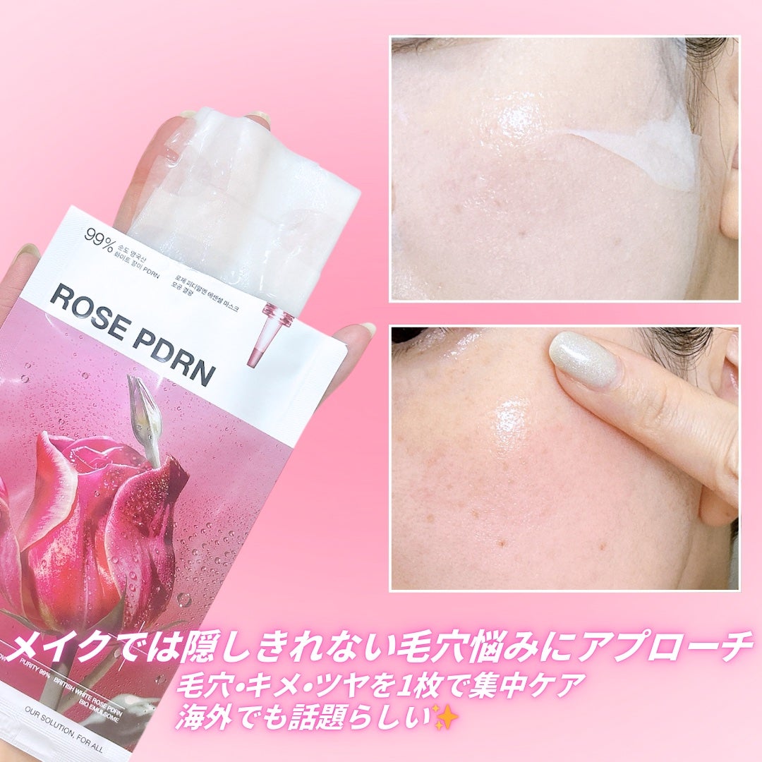 ローゼPDRNエッセンシャルマスクヘルシーグロウ/MEDIHEAL/シートマスク・パックを使ったクチコミ(2枚目)