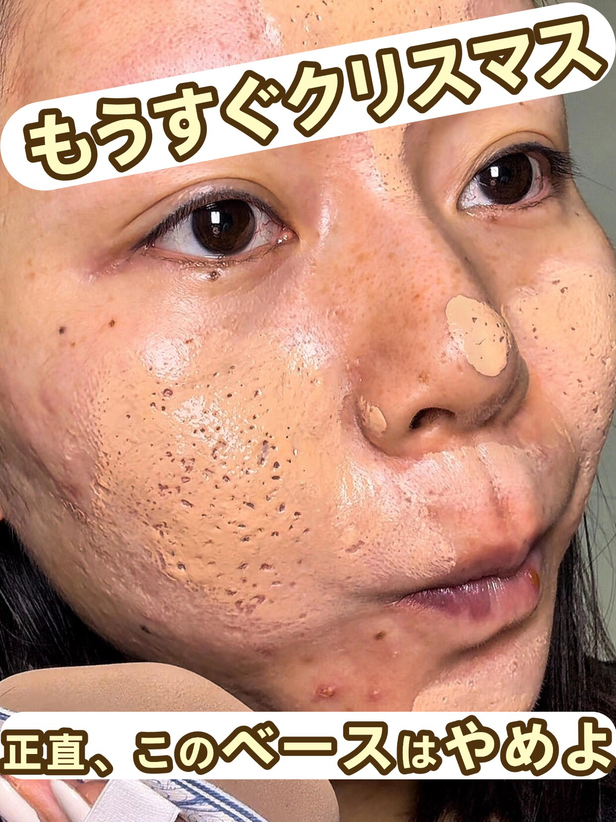 アネトス バランシング トリートメントクリーム/Anetos/フェイスクリームを使ったクチコミ（1枚目）