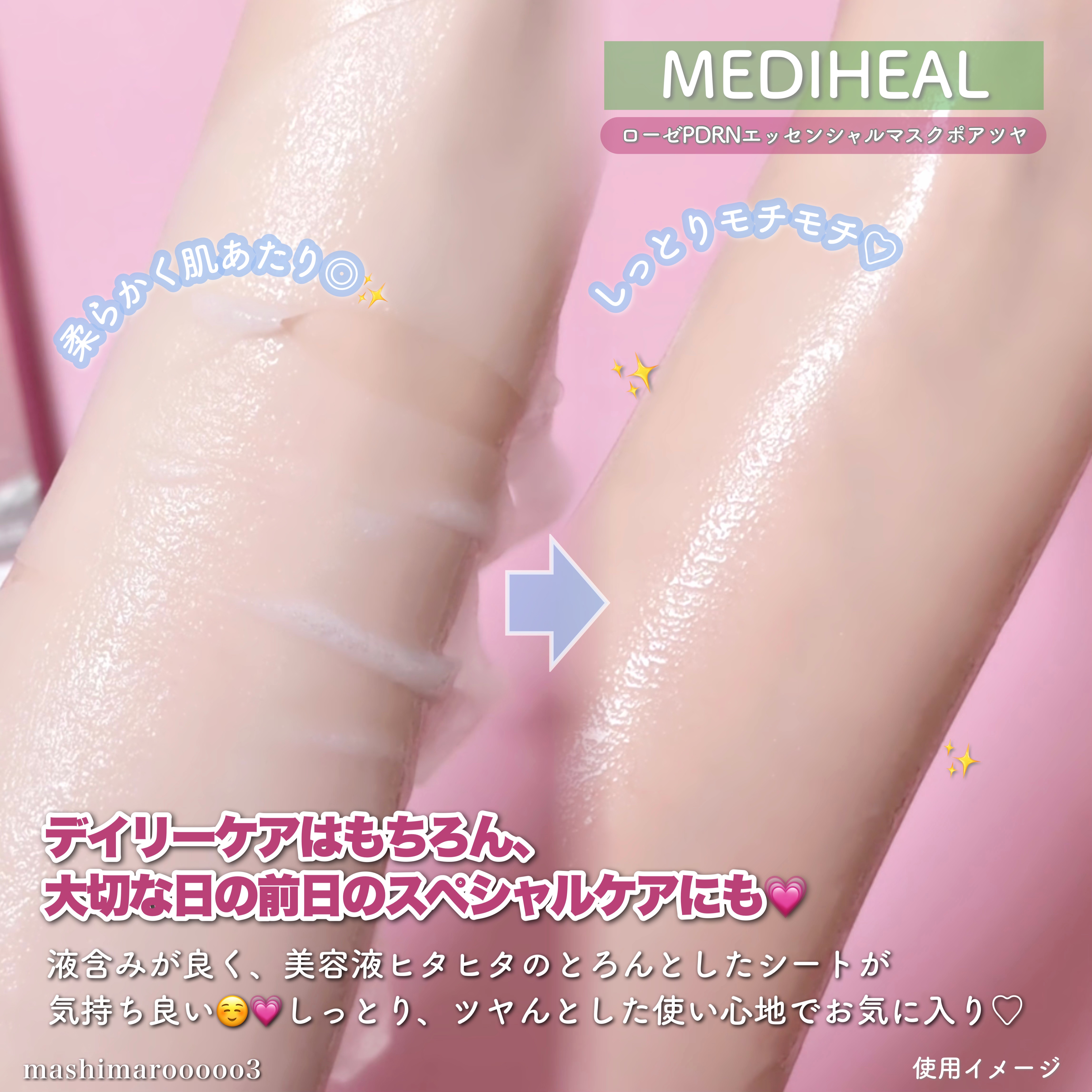 ローゼPDRNエッセンシャルマスクヘルシーグロウ/MEDIHEAL/シートマスク・パックを使ったクチコミ（3枚目）