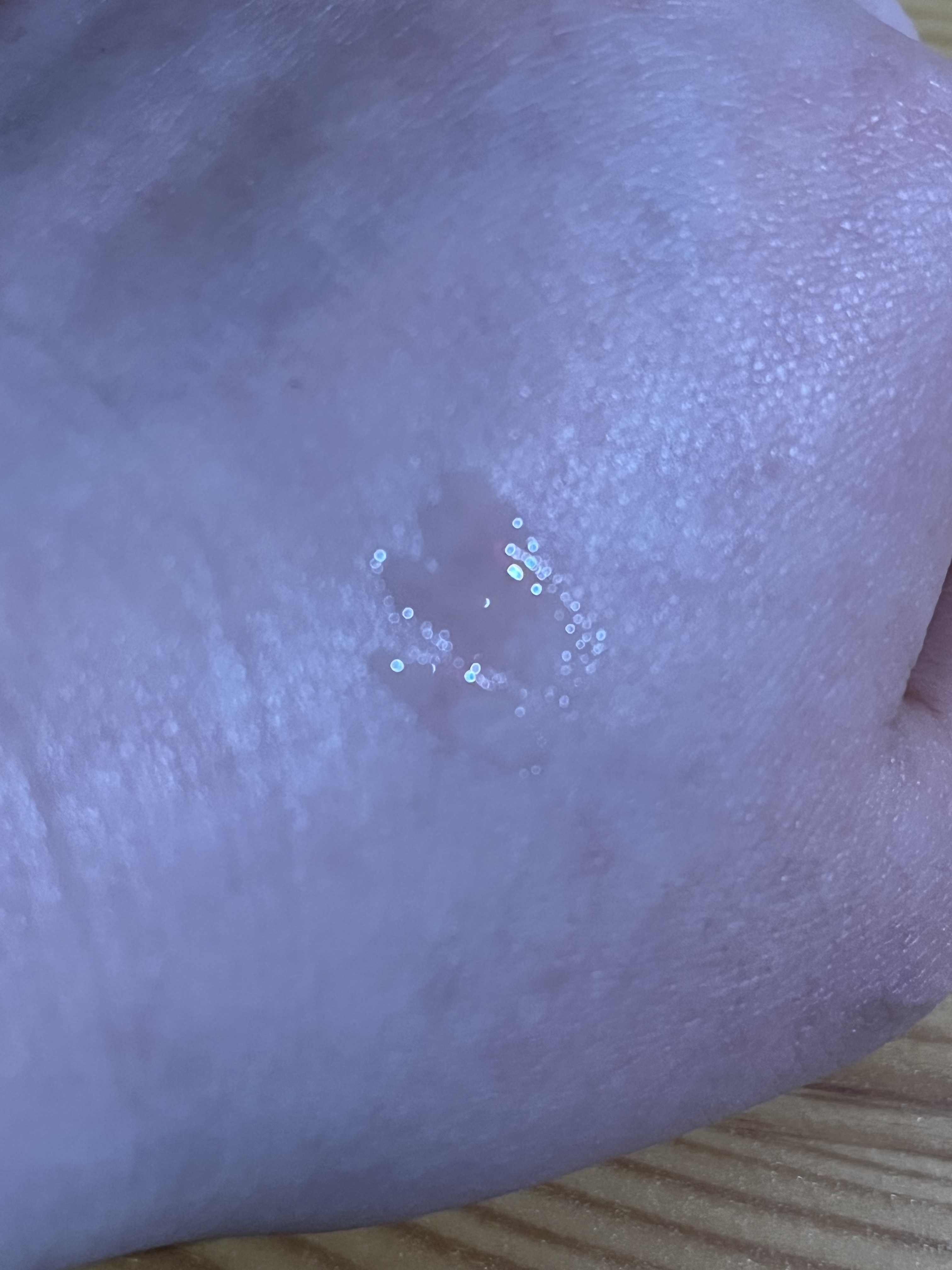 ボリュームプラス リップエッセンスUV/アンテリージェEX/リップ美容液を使ったクチコミ（3枚目）