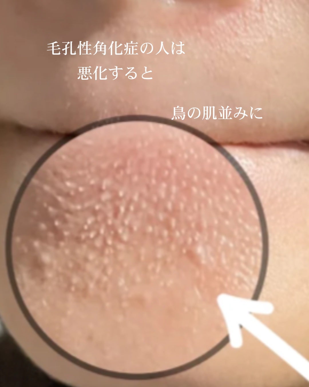 アネトス マイルド フェイシャル クレンザー/Anetos/洗顔フォームを使ったクチコミ(3枚目)