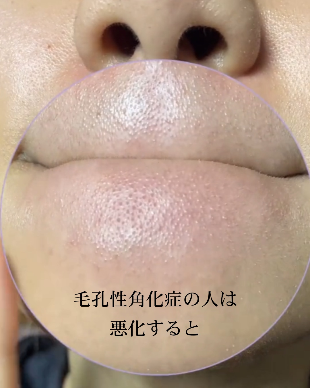 アネトス マイルド フェイシャル クレンザー/Anetos/洗顔フォームを使ったクチコミ（1枚目）