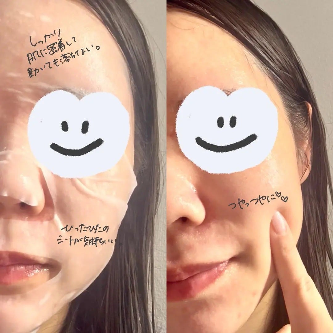 ローゼPDRNエッセンシャルマスクヘルシーグロウ/MEDIHEAL/シートマスク・パックを使ったクチコミ(4枚目)