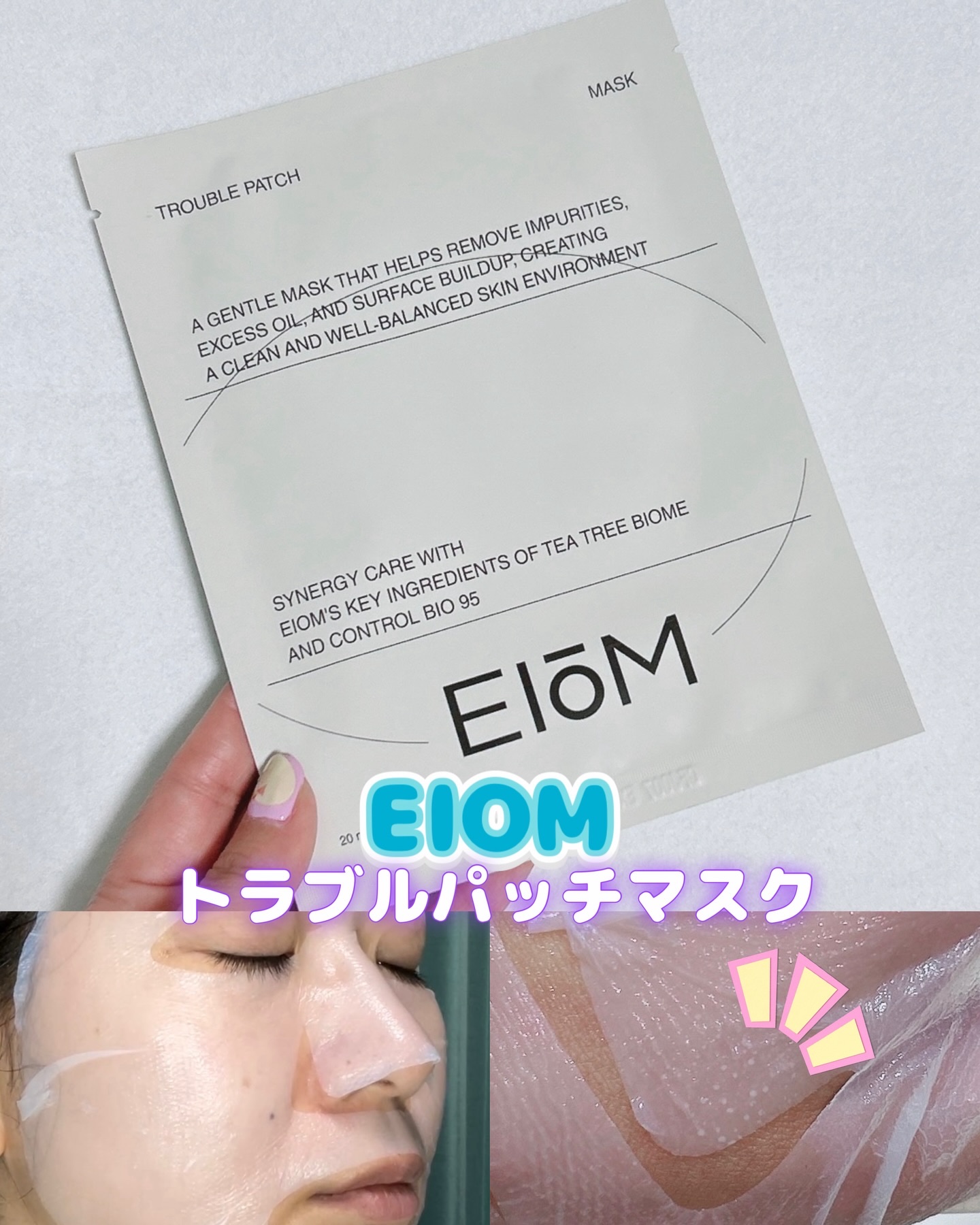 トラブルパッチマスク/EIOM/その他スキンケアを使ったクチコミ（1枚目）