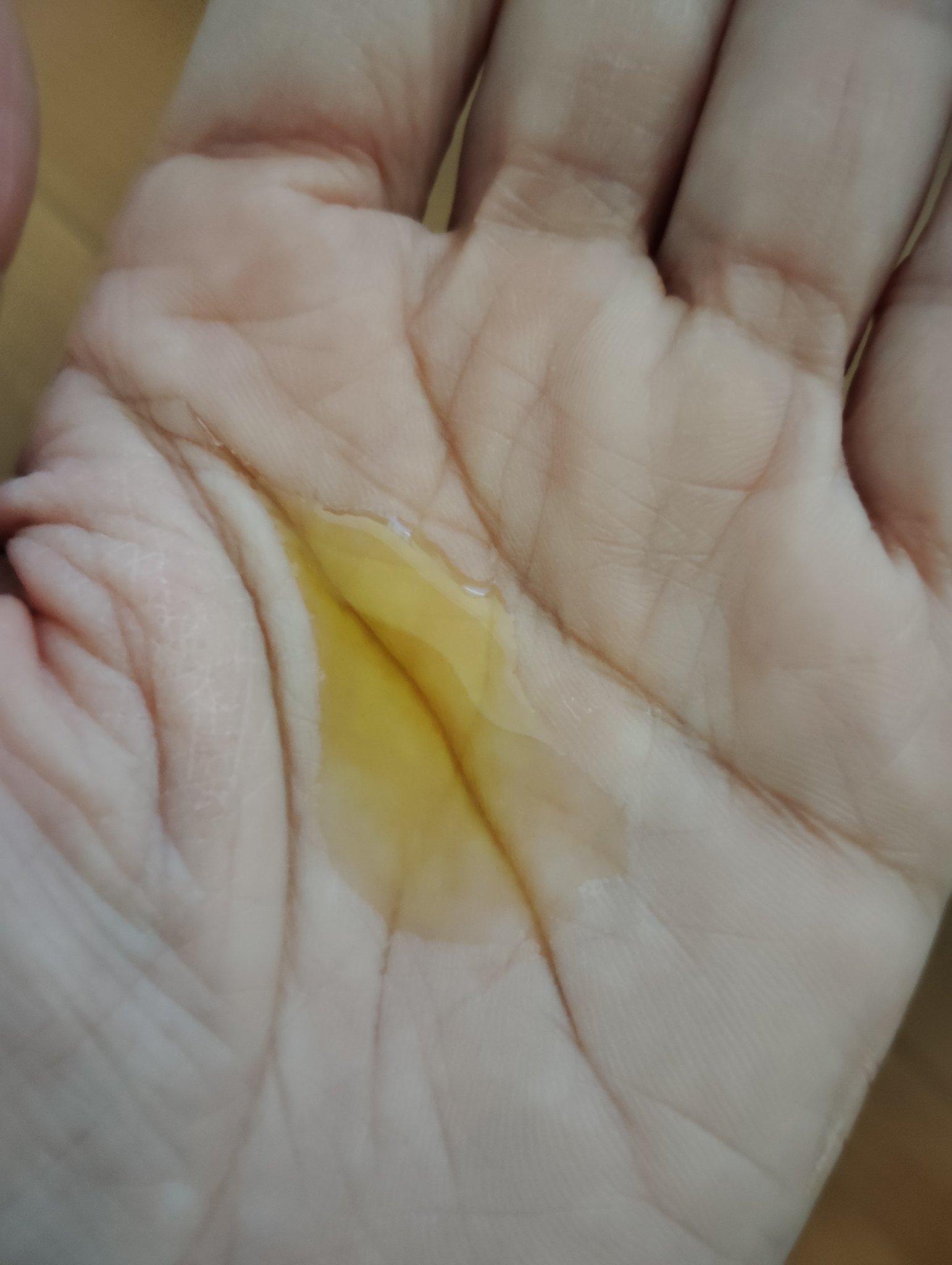 アルニカ マッサージオイル /WELEDA/ボディオイルを使ったクチコミ（2枚目）