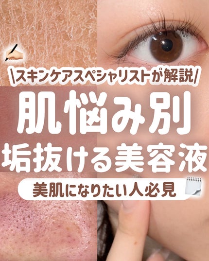 タカミスキンピール/タカミ/ブースター・導入液を使ったクチコミ(1枚目)