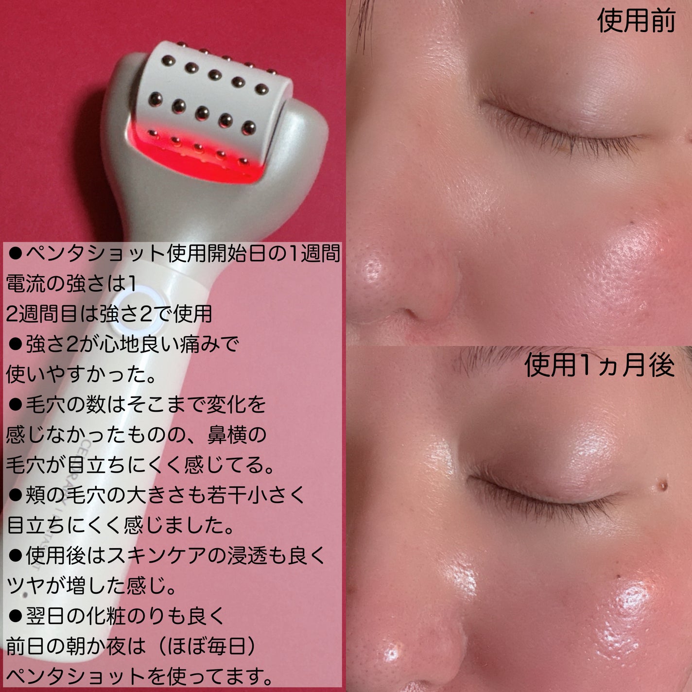 ペンタショット/CELORABY/美顔器・マッサージを使ったクチコミ(3枚目)