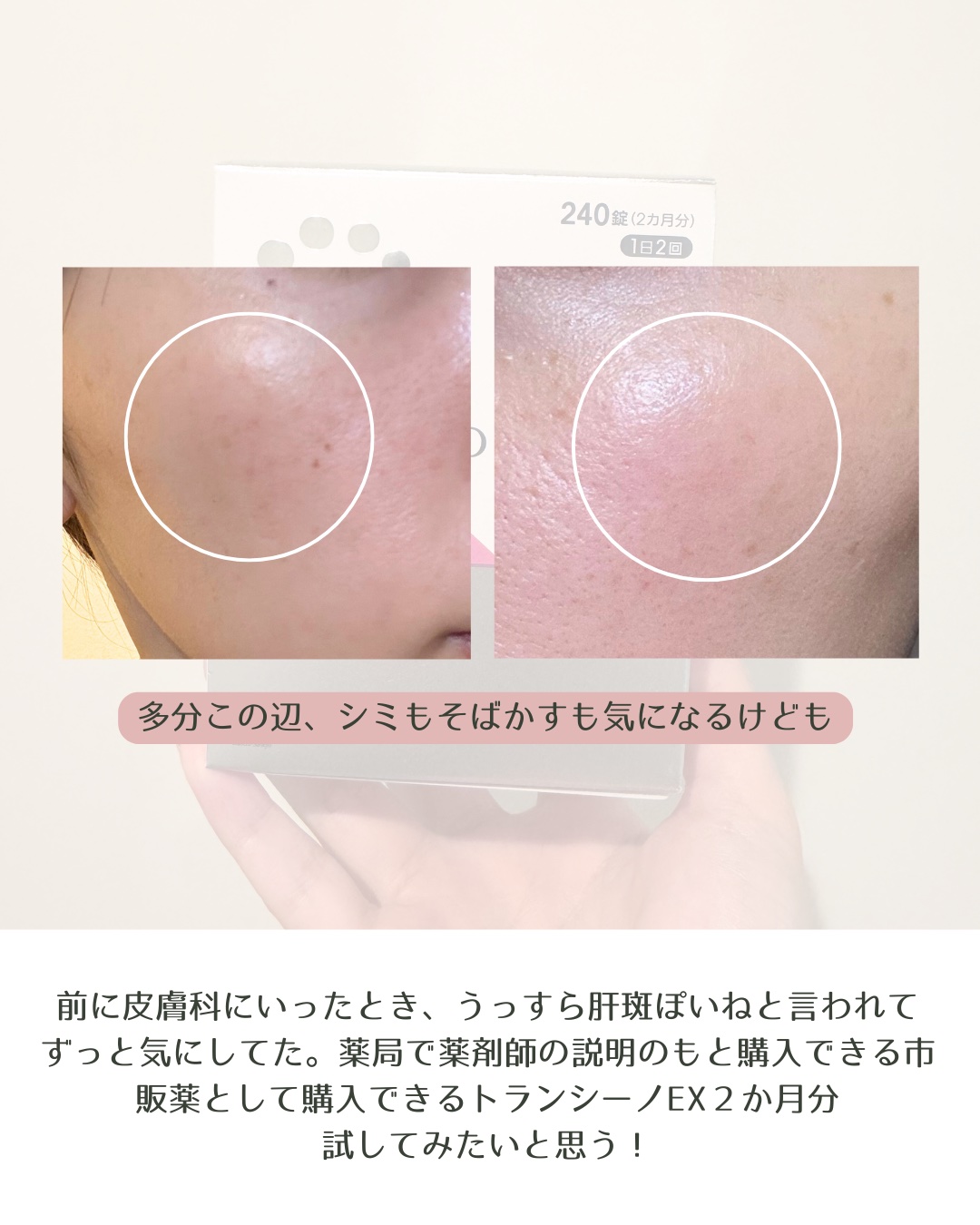 トランシーノEX/トランシーノ/美容サプリメントを使ったクチコミ（2枚目）