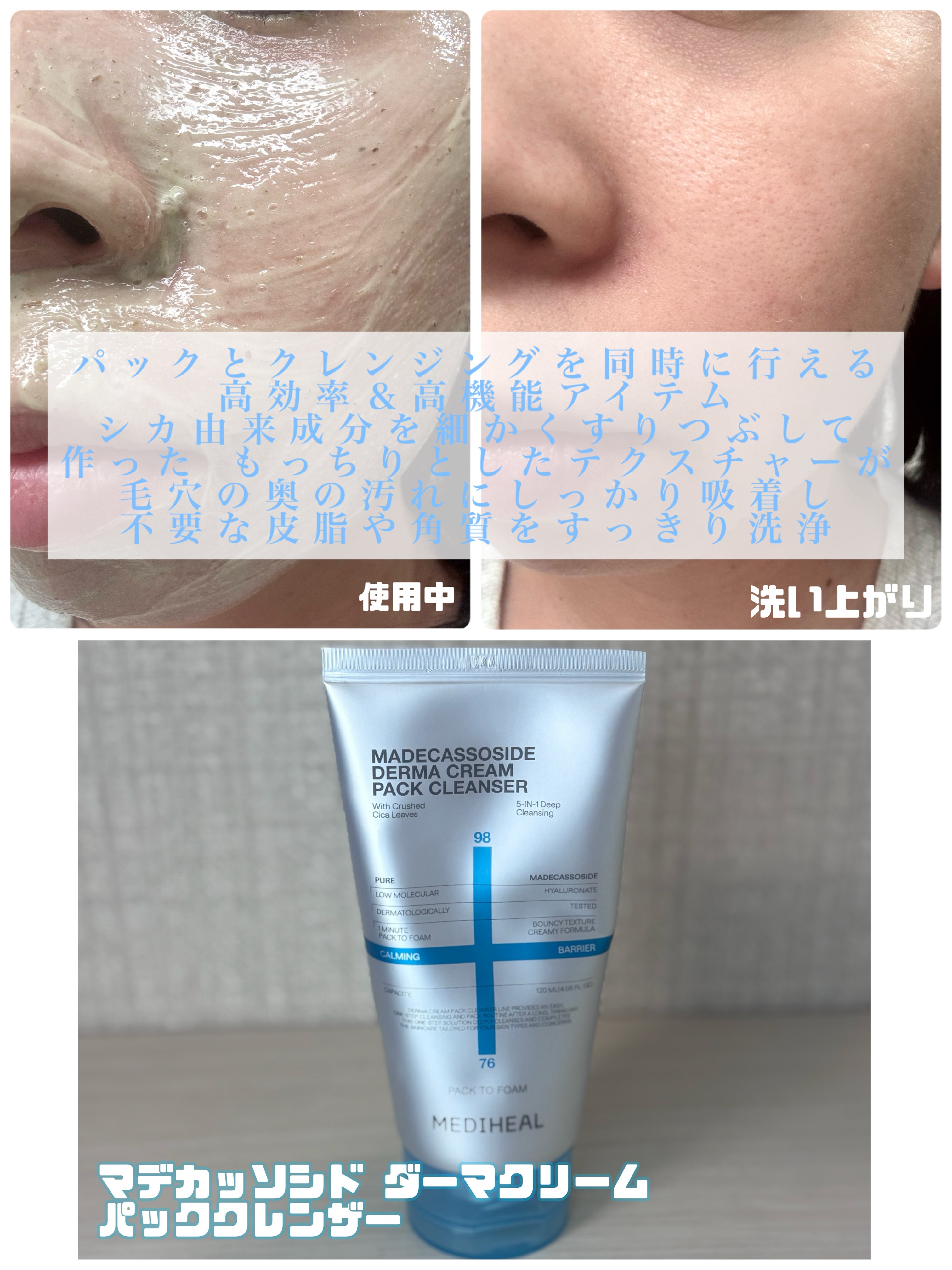 マデカッソシド ブレミッシュマスク/MEDIHEAL/シートマスク・パックを使ったクチコミ（2枚目）