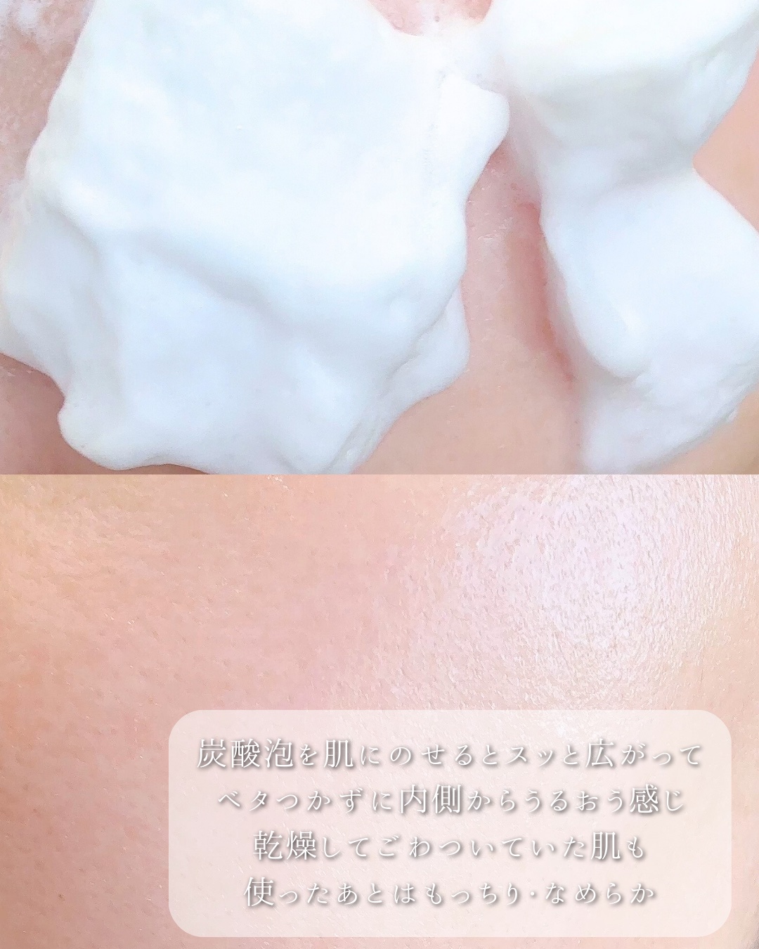 GASH エアバブルCDSマスクU  V-アクアボムのクチコミ「ロフト・プラザ・ドンキで販売中✨
10秒間泡パックで、
乾燥した肌にうるおいチャージ🫧
高純度.....」（3枚目）