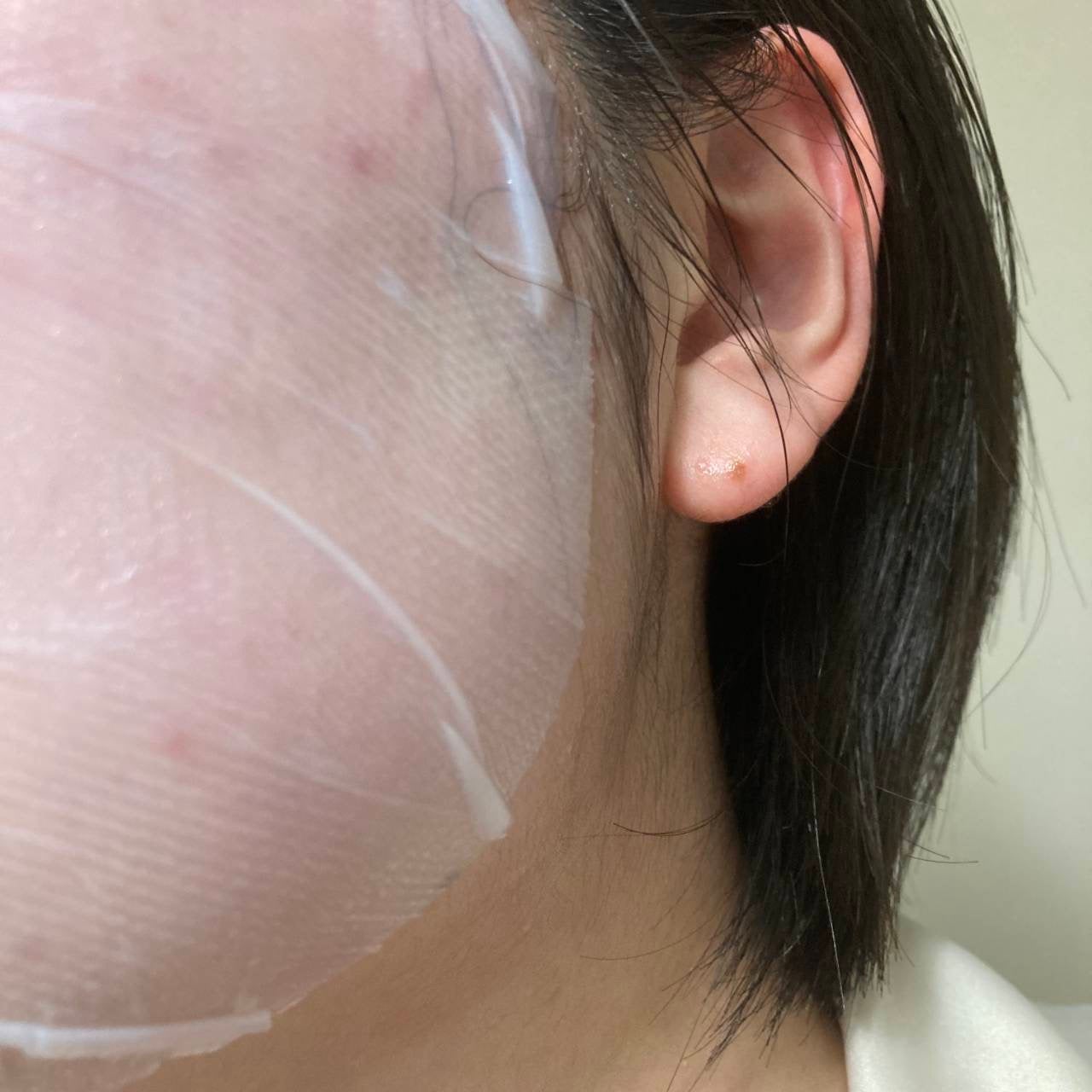 トラブルパッチマスク/EIOM/その他スキンケアを使ったクチコミ(4枚目)