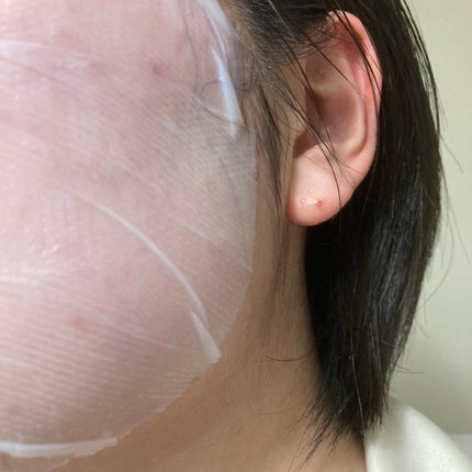 トラブルパッチマスク/EIOM/その他スキンケアを使ったクチコミ(4枚目)