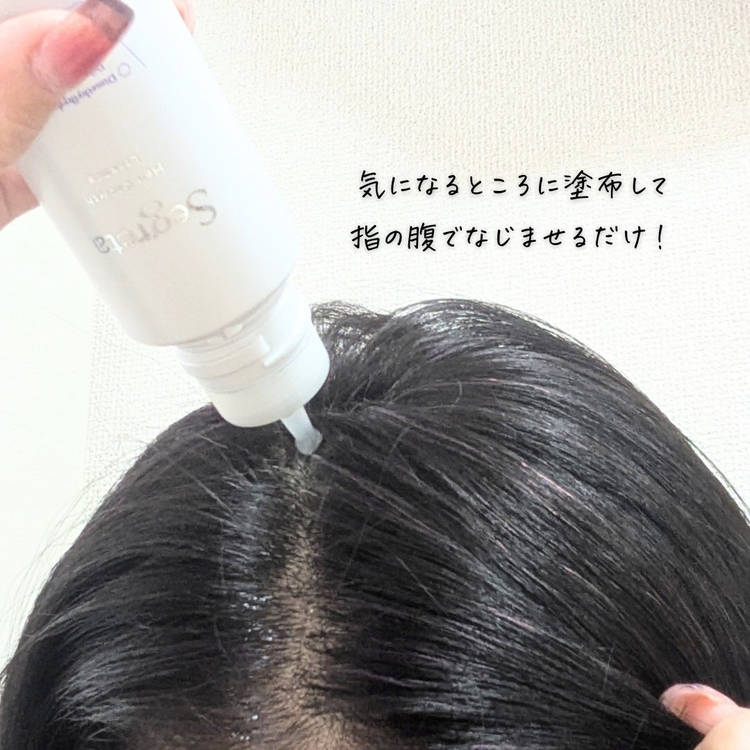 セグレタ 育毛エッセンス/花王/頭皮ローションを使ったクチコミ(8枚目)