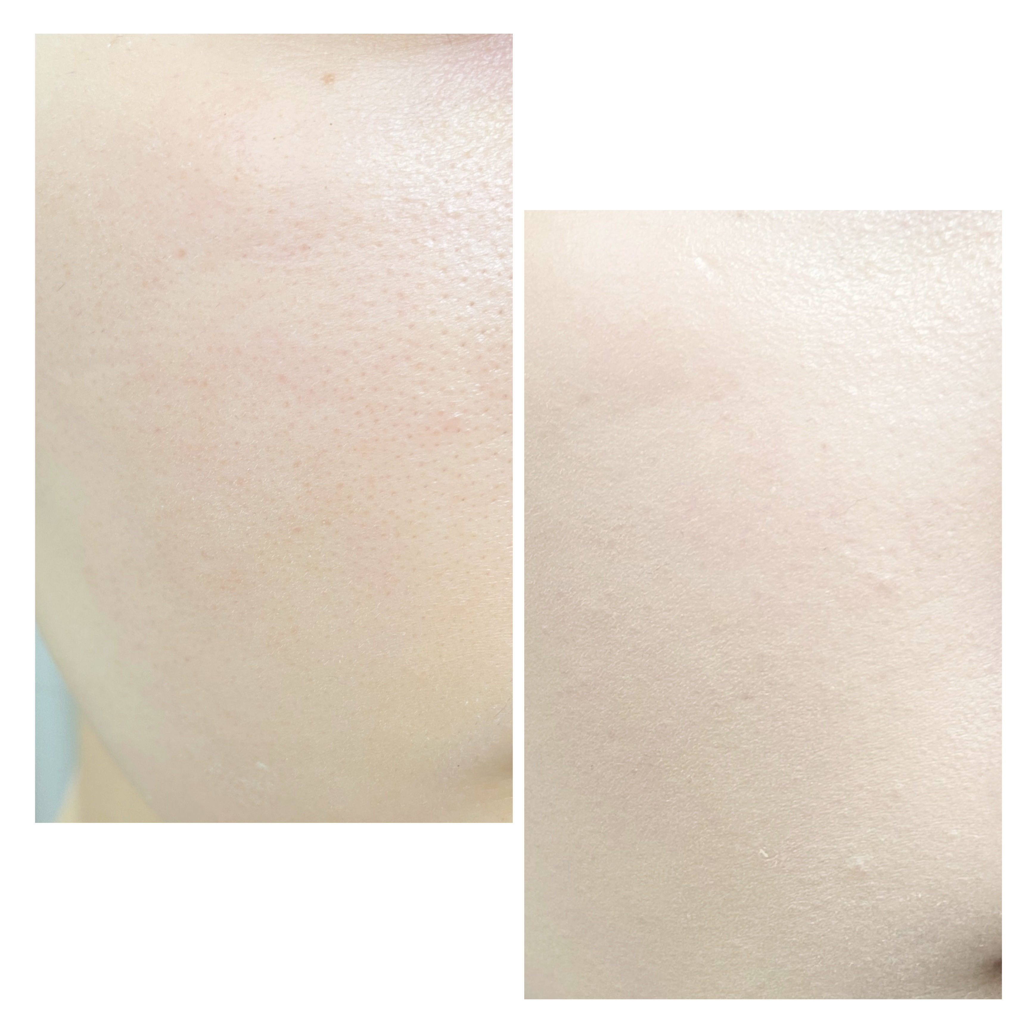 VDL カバーステイン パーフェクティング クッション ファンデーションのクチコミ「VDL
カバーステイン パーフェクティング クッション 
SPF35 PA＋＋

M01 ピン.....」（2枚目）