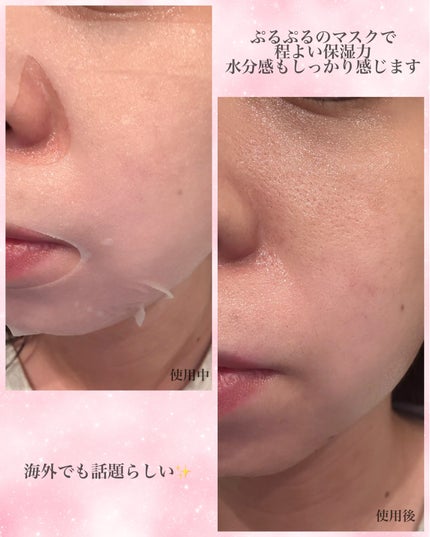 ローゼPDRNエッセンシャルマスクヘルシーグロウ/MEDIHEAL/シートマスク・パックを使ったクチコミ(2枚目)