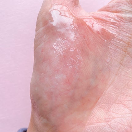 生VC美白美容液/Yunth/美容液を使ったクチコミ(4枚目)