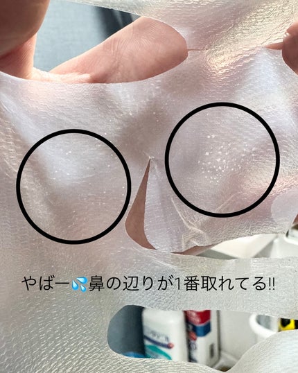 トラブルパッチマスク/EIOM/その他スキンケアを使ったクチコミ(5枚目)