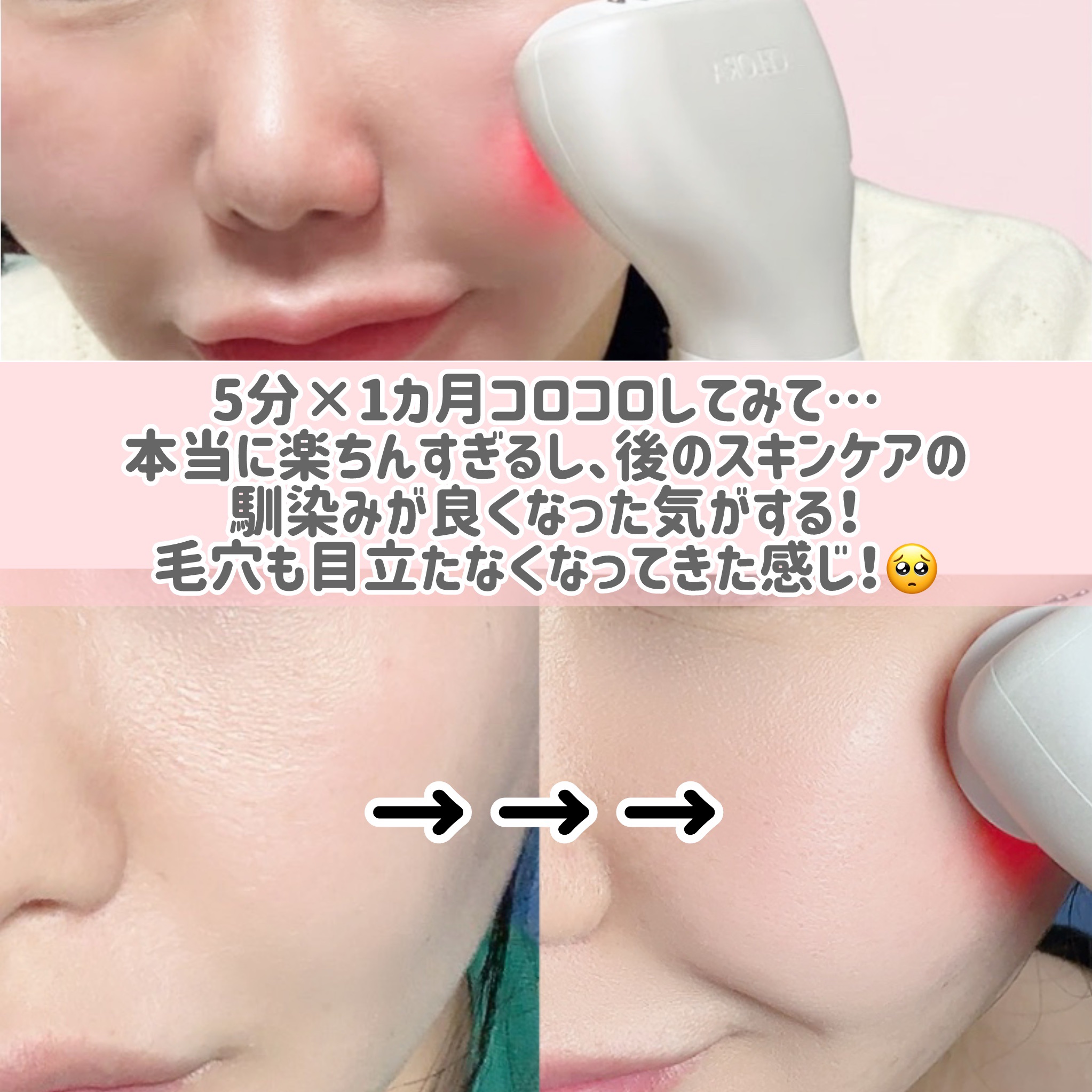 ペンタショット/CELORABY/美顔器・マッサージを使ったクチコミ（3枚目）