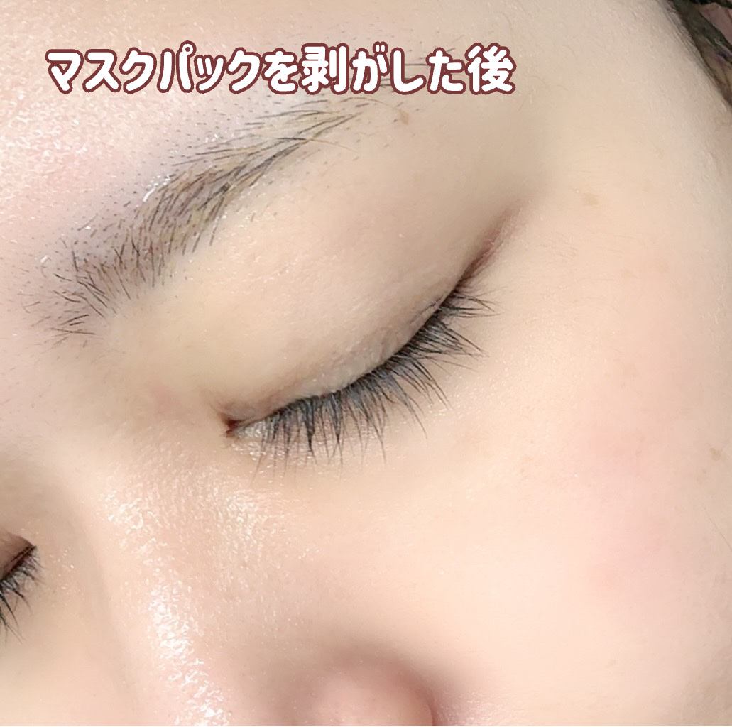 ローゼPDRNエッセンシャルマスクヘルシーグロウ/MEDIHEAL/シートマスク・パックを使ったクチコミ（3枚目）