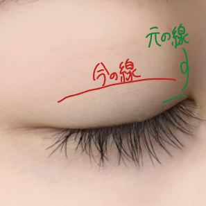 アイトーク スーパーホールド/アイトーク/二重まぶた用アイテムを使ったクチコミ(3枚目)