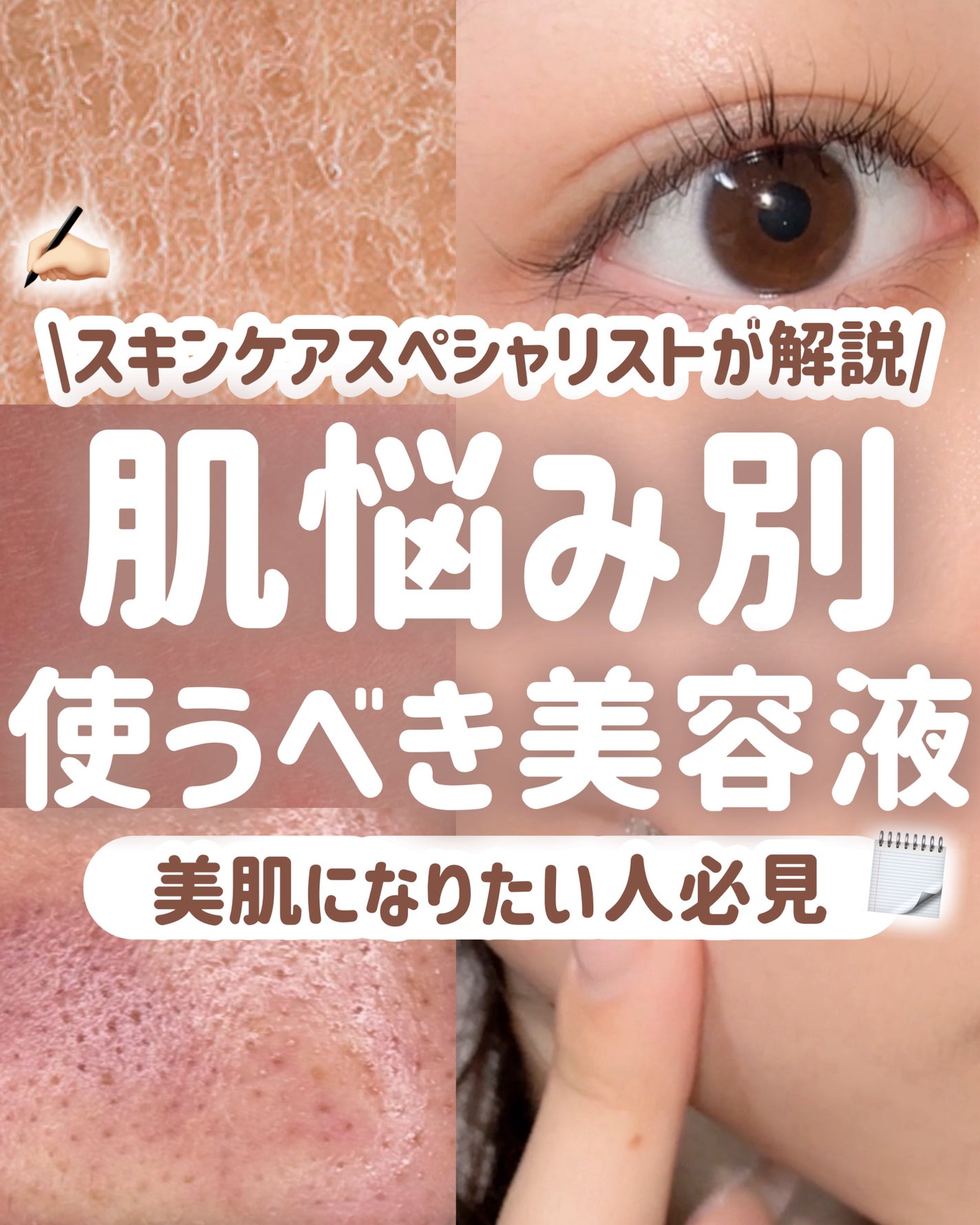 タカミスキンピール/タカミ/ブースター・導入液を使ったクチコミ(1枚目)