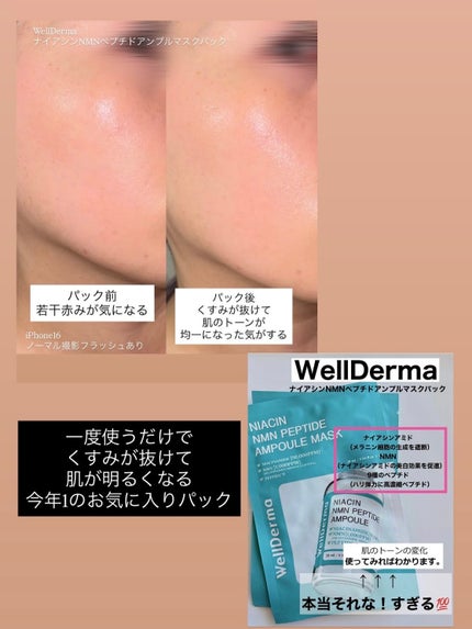 ナイアシンNMNペプチドアンプルマスクパック/WellDerma/シートマスク・パックを使ったクチコミ(3枚目)